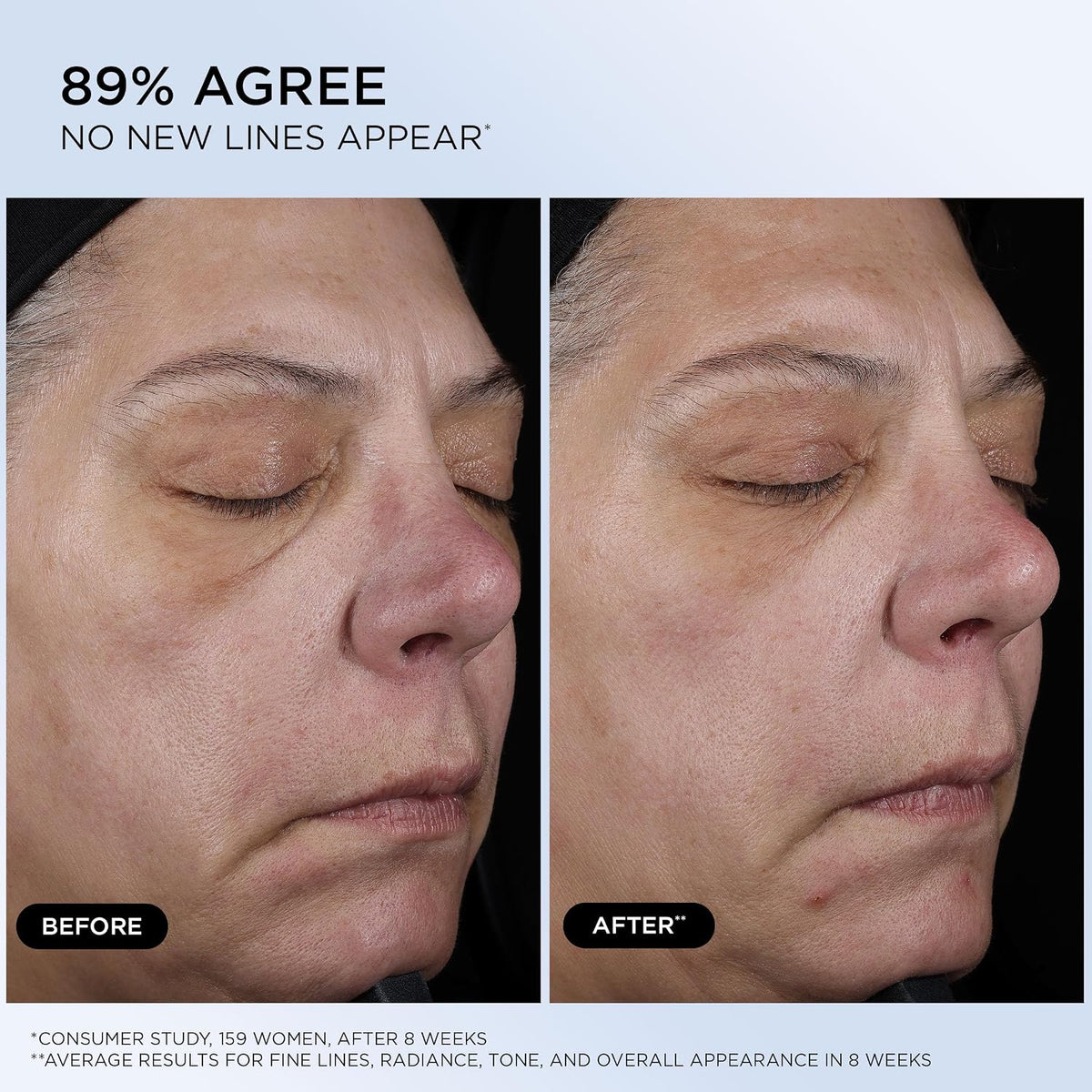 Ultimate Recovery Serum - Hydrating Anti Aging Face Serum